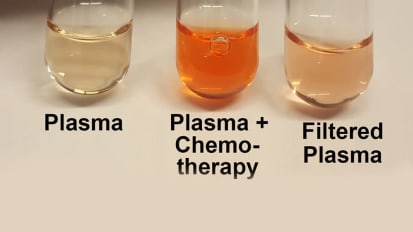 Preventing Chemotherapy From Overstaying Its Welcome
