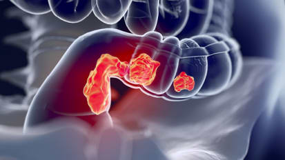 Innovative Approaches to Colorectal Surgery Benefit Patients