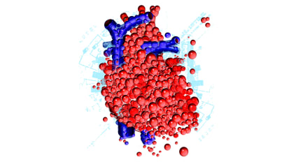 Advanced Coronary Revascularization for Severe Coronary Disease