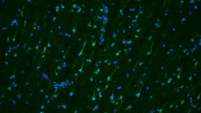 Study of living brain tissue reveals how Parkinson’s treatment works