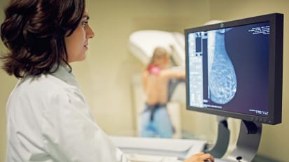 Inclusion of New Risk Factors Can Improve Prediction of Invasive Breast Cancer