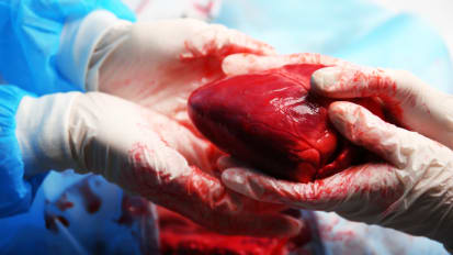 Why Heart Transplants Are So Rewarding and So Challenging Today