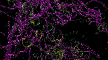 Institute Is Expanding the Understanding of Diabetes, Obesity, and Metabolism