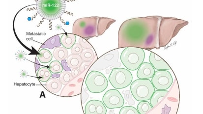 UT Southwestern Develops Nanotherapeutic to Ward Off Liver Cancer