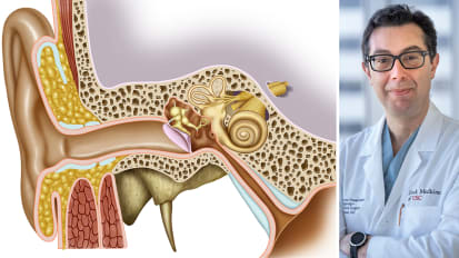 Pushing the Envelope with Surgery to Restore Hearing: Notes from a Leading Otolaryngology Program