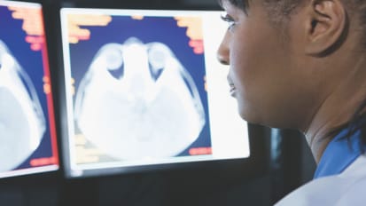 UCI Health earns NAEC Level 4 Epilepsy Center certification