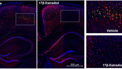 Estrogen May Offer Protection Against Delirium