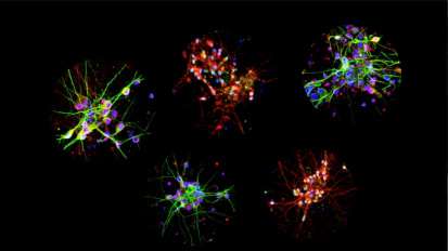 The Friedman Brain Institute Fall 2022 Report