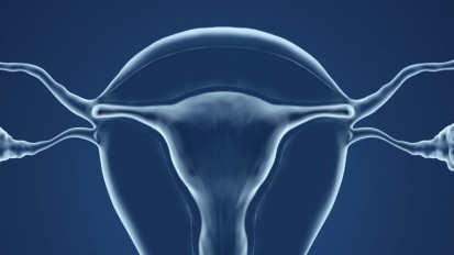 Fertility-sparing Surgeries for Gynecologic Cancer