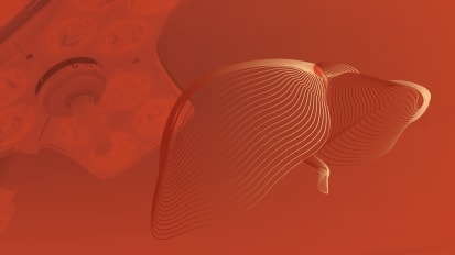 Redefining Excellence in Liver Transplantation