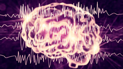 Forecasting May Help People with Epilepsy Predict Their Seizures