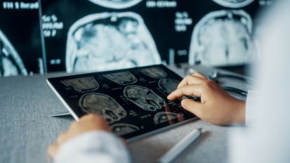 This AI Tool Helps Neurosurgeons Find Sneaky Cancer Cells
