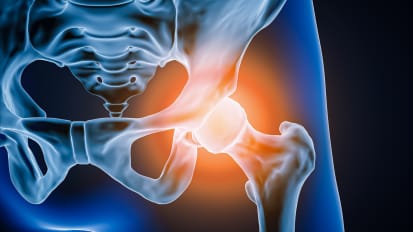 Cedars-Sinai Welcomes New Director of Hip Preservation