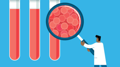 Early Cancer Detection Studies for High-Risk People