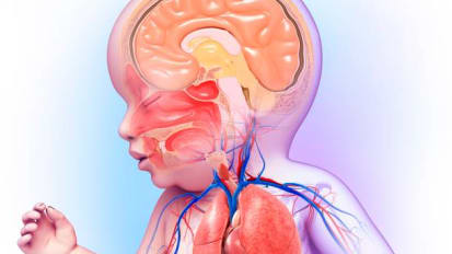 Caring for the Heart and Brain: A New Model for Babies With CHD