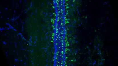 New Discovery Reveals Pathway to Modulate Scarring in Spinal Cord Injury