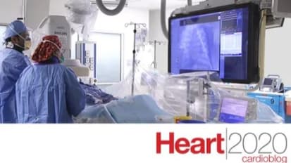 Transradial Angioplasty – a Handy Fix for Blocked Coronary Arteries
