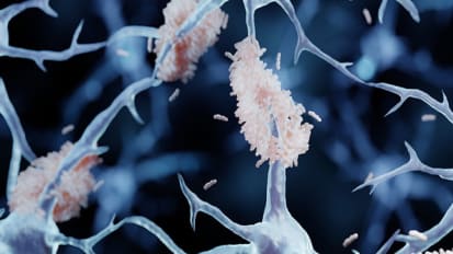 Heart and Brain Link