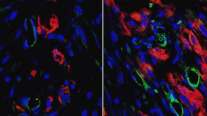 In Vitro Grafts Increase Blood Flow In Infarcted Rat Hearts