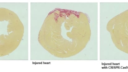 Gene Editing Halts Damage in Mice After Heart Attacks in UT Southwestern Study