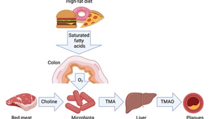 A Precision Medicine Approach to a Common Type of Heart Failure