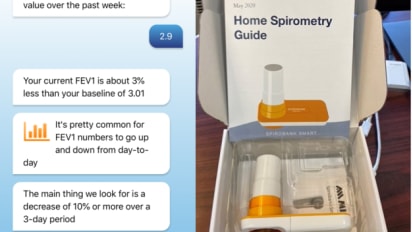 Virtual Monitoring for Lung Transplant Patients Aided by Home Spirometry Device