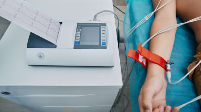 How Many People Have A-Fib? Three Times More Than We Thought