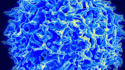 Killing Pancreatic Cancer with T Cells that Turbocharge Themselves