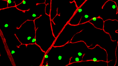 How Neurons Build a 3-D Vascular Structure to Keep the Retina Healthy