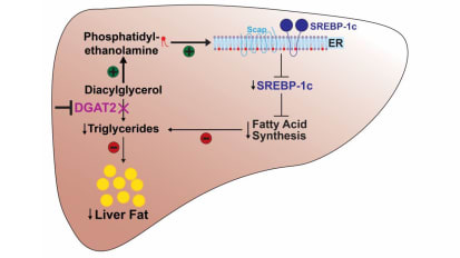 How an experimental drug reverses fatty liver disease