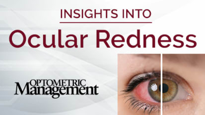 Tricks & Treats of Ocular Redness
