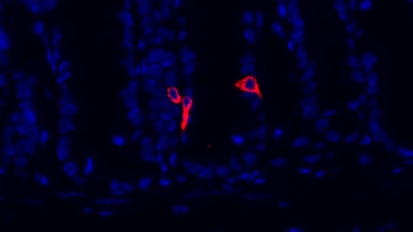 Research could lead to treatments for obesity, extreme weight loss