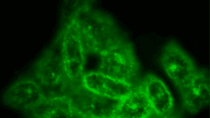 New Clues Link Cholesterol To Fertility