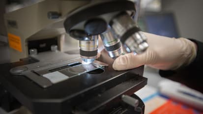 New Insights Into Intellectual Disability Genetics Emerge at Mount Sinai