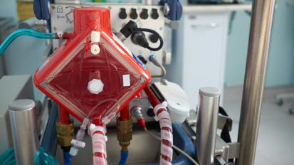 ECMO in Advanced Cardiopulmonary Failure: Patient Selection, Ventricular Unloading and Evolving Support Strategies