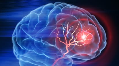 Neuroscience Researchers Studying Stem Cells for Acute Stroke