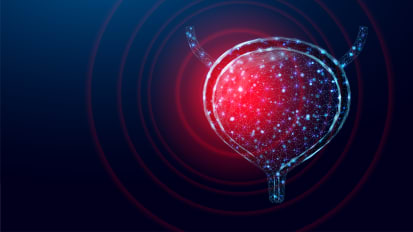 INSITE Trial Looking to Identify Which Patients Can Forgo Cystectomy