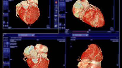 When to Refer; When to Act: Evolving Decision-Making in Aortic Disease Management