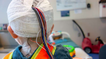 The Future of Pediatric Epilepsy Surgery Through a Genetic Lens