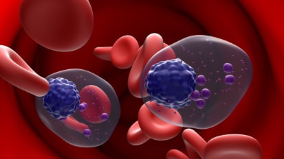 Fox Chase Cancer Center and Temple Health Physicians and Scientists Present Research at the American Society of Hematology 2024 Annual Meeting
