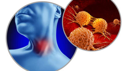 Lifting the Stigma of HPV-Associated Oropharyngeal Cancer: Insights from Dr. Tom Thomas at Morristown Medical Center