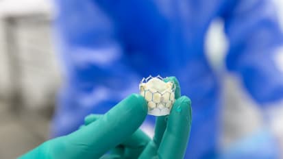 Advanced Heart Valve Procedures Expand Treatments for Patients With Limited Options