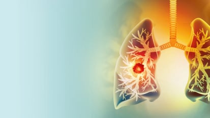 Project ASCENT: Advancing Lung Cancer Screening in Hispanic Populations