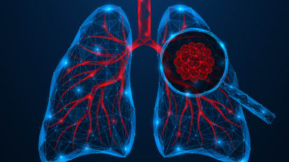 Lung Cancer Treatment Evolutions Include Surgical Innovation and Molecular Targeted Therapy