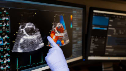 Deciphering New Study on Heart Disease Deaths Linked to Modifiable Risk Factors