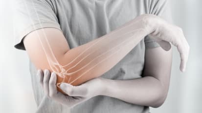 When Conservative Care Falls Short: A Stepwise, Nonsurgical Pathway for Chronic Tendinopathy