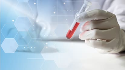 A Routine Blood Test Could Help Predict Who Benefits Most from CAR T-Cell Therapy