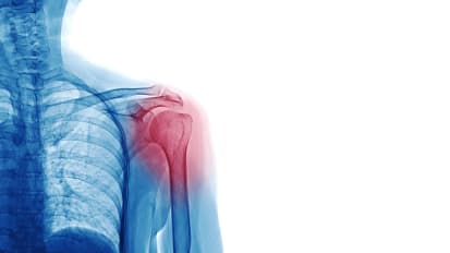 He Thought His Hockey Days Were Over. An Innovative Approach at Baptist Health Orthopedic Care Made the Difference