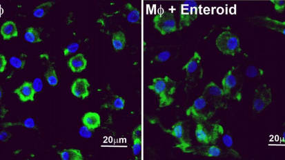 3D Tissue Models Offer Window into How Gut Cells Fight Infection