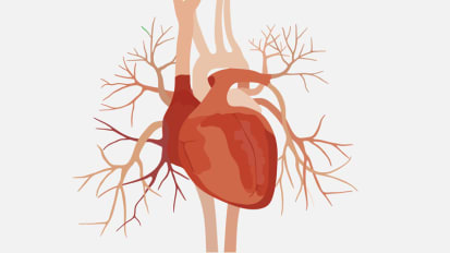 Cardiologists and Engineers Collaborate to Create New Treatments for Heart Disease